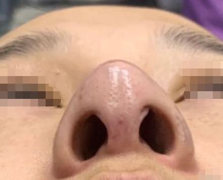 8.png