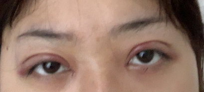 10.png