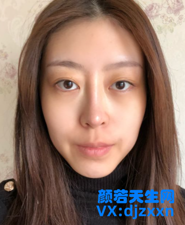 3_副本_副本.png