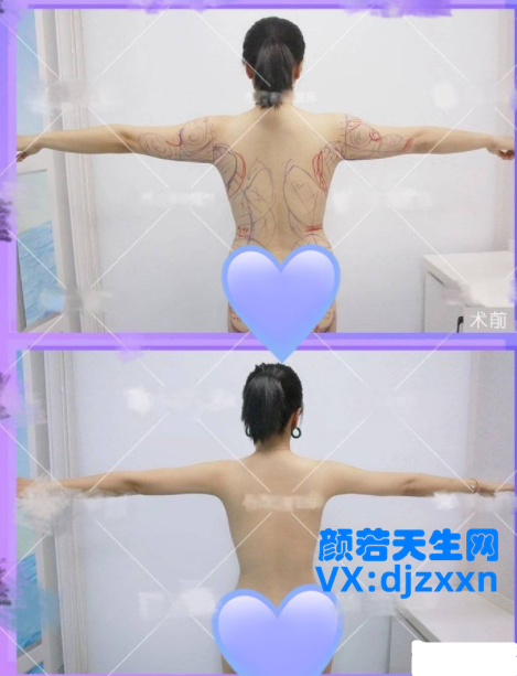 1_副本.png