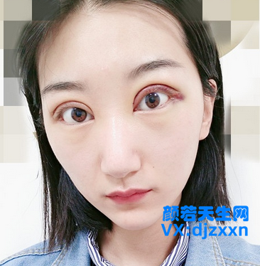 5.png