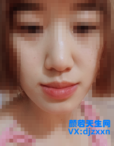 4.png