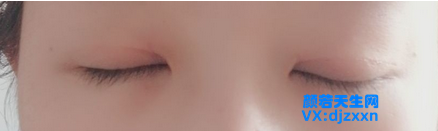 14.png