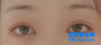 10.png