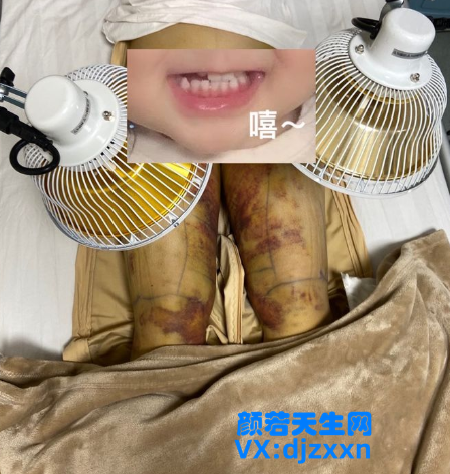 7.png