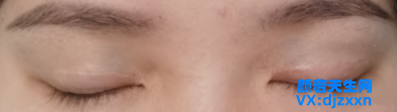 15.png