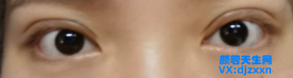 7.png
