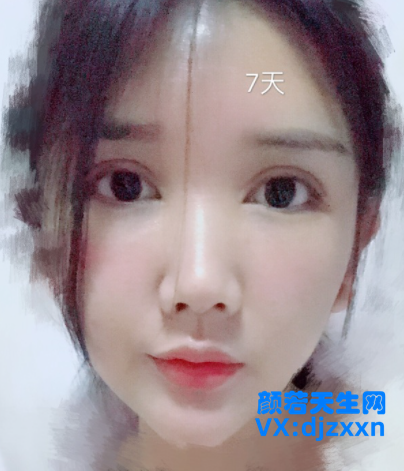 16.png