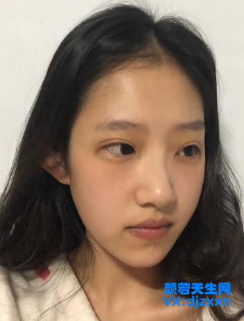 1.png 1.png