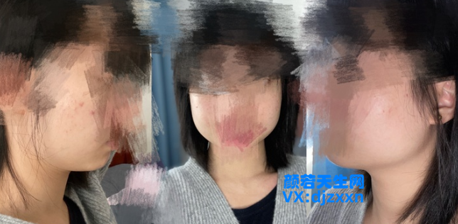 aa1.png aa1.png