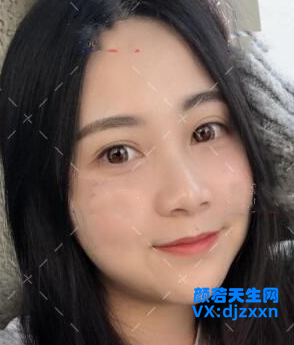 11.png